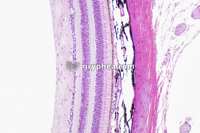 Rétine avec choroîde et sclérotique x25_1 - gryphea.org